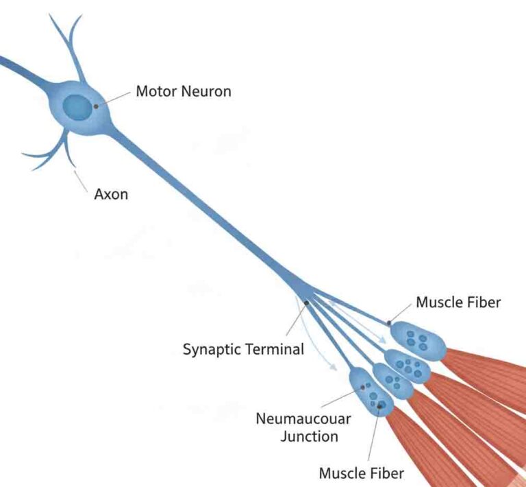 Simplified diagram of motor neuron connection to muscle fibers in ALS